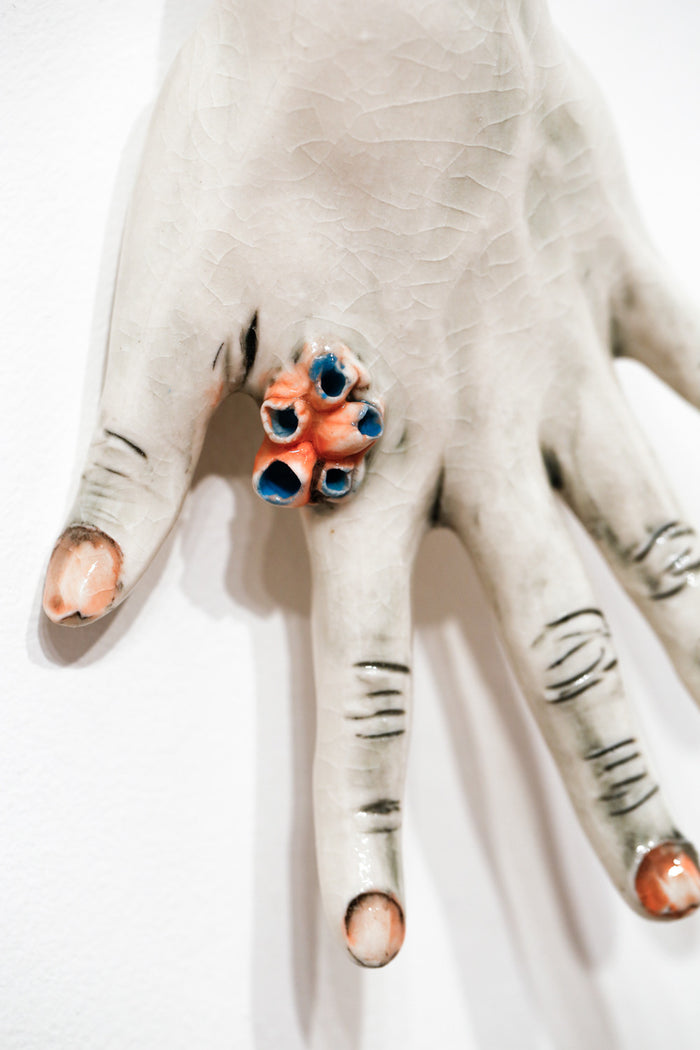 The Long Arm Reaches Out: Hands and Feet Series 33