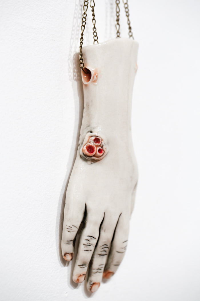 The Long Arm Reaches Out: Hands and Feet Series 34