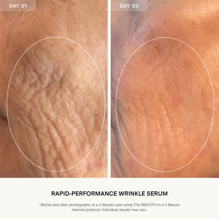 The SMOOTH Dynamic Wrinkle Defense Serum